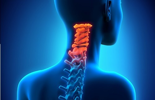 ‌ اسپونديلوز گردن‌ : cervical spondylosis  اطلاعات‌ اوليه‌...
